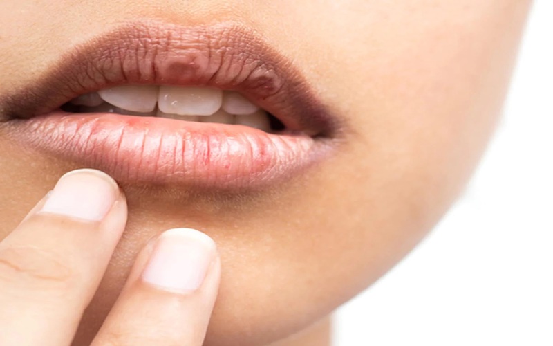 The best balm for dry lip